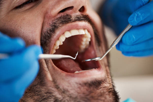 Best Emergency Tooth Extraction  in Humboldt, KS